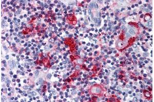 Anti-CCR9 antibody  ABIN1048406 IHC staining of human thymus. (CCR9 antibody  (Extracellular Domain))
