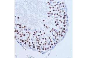 Immunohistochemistry (IHC) image for anti-Matrin 3 (MATR3) (AA 747-847) antibody (ABIN7268415)