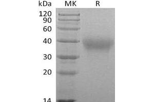 Western Blotting (WB) image for Hepatitis A Virus Cellular Receptor 2 (TIM 3) protein (His tag) (ABIN7320991) (TIM3 Protein (His tag))