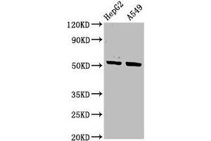 Western Blot Positive WB detected in: HepG2 whole cell lysate, A549 whole cell lysate All lanes: KRT16 antibody at 3. (KRT16 antibody  (AA 265-333))