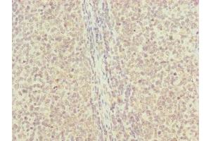 Immunohistochemistry of paraffin-embedded human tonsil tissue using ABIN7151143 at dilution of 1:100 (RNF13 antibody  (AA 204-381))