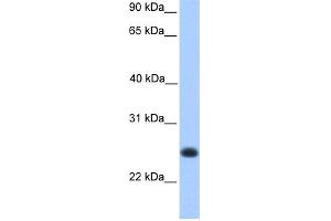 WB Suggested Anti-C12orf68 Antibody Titration: 0. (C12ORF68 antibody  (Middle Region))