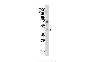 Western blot analysis of anti-LEFTB Pab in HL60 cell line lysates (35ug/lane). (LEFTY1 antibody  (C-Term))