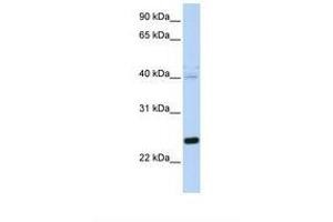 Image no. 1 for anti-Heat Shock 22kDa Protein 8 (HSPB8) (N-Term) antibody (ABIN6739048) (HSPB8 antibody  (N-Term))