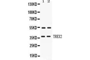 Western blot analysis of TREX2 expression in HELA whole cell lysates ( Lane 1) and MCF-7 whole cell lysates ( Lane 2). (TREX2 antibody  (AA 69-279))