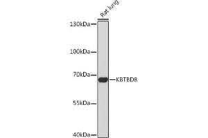 Western blot analysis of extracts of Rat lung, using KBTBD8 Rabbit pAb (ABIN7268076) at 1:1000 dilution. (KBTBD8 antibody)