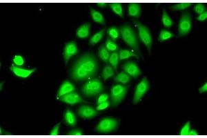 Immunofluorescence analysis of MCF7 cells using SPDEF Polyclonal Antibody (SPDEF/PSE antibody)