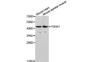 Western blot analysis of extracts of various cell lines, using PDHA1 antibody.