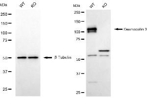 Western blotting analysis using desmocollin 3 antibody (ABIN7798316). (Recombinant Desmocollin 3 antibody)