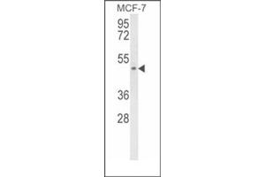 Western blot analysis of SCD5 Antibody (Center) Cat. (SCD5 antibody  (Middle Region))