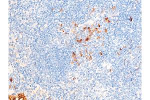 Immunohistochemistry (IHC) image for anti-Checkpoint Kinase 1 (CHEK1) (pSer286) antibody (ABIN6255167)