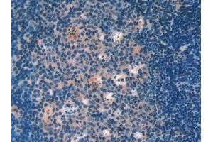 Detection of GAL9 in Mouse Lymph node Tissue using Polyclonal Antibody to Galectin 9 (GAL9) (Galectin 9 antibody  (AA 225-353))