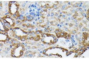 Immunohistochemistry of paraffin-embedded Mouse kidney using KRT14 Polyclonal Antibody at dilution of 1:100 (40x lens). (KRT14 antibody)