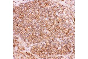 Immunohistochemistry (IHC) image for anti-Nuclear Factor of kappa Light Polypeptide Gene Enhancer in B-Cells 2 (NFKB2) (AA 1-340) antibody (ABIN3043293)