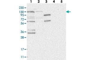 Western blot analysis of Lane 1: RT-4, Lane 2: U-251 MG, Lane 3: Human Plasma, Lane 4: Liver, Lane 5: Tonsil with HEATR6 polyclonal antibody .