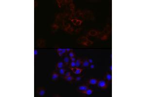 Immunofluorescence analysis of HepG2 cells using ApoB Rabbit pAb (ABIN3015447, ABIN3015448, ABIN5663872 and ABIN6217244) at dilution of 1:50 (40x lens). (APOB antibody  (AA 28-330))