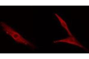 ABIN6278590 staining NIH-3T3 cells by IF/ICC. (MDM1 antibody  (Internal Region))