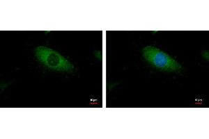 ICC/IF Image BCAR1 antibody [N2C2], Internal detects BCAR1 protein at cytoplasm by immunofluorescent analysis. (BCAR1 antibody  (Internal Region))