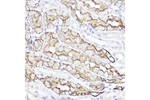 Immunohistochemistry of paraffin-embedded mouse kidney using Aquaporin-1  Rabbit pAb (ABIN7265651) at dilution of 1:100 (40x lens). (Aquaporin 1 antibody  (C-Term))