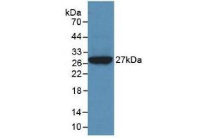 Western Blotting (WB) image for Clusterin (CLU) ELISA Kit (ABIN6574258)