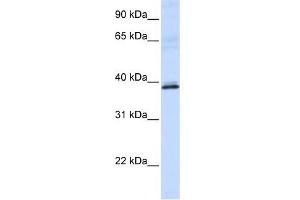 HAO2 antibody used at 1 ug/ml to detect target protein.