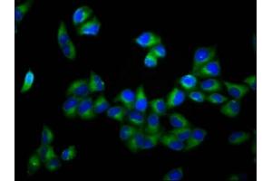 Immunofluorescence staining of Hela cells with ABIN7150052 at 1:166, counter-stained with DAPI. (ADAM29 antibody  (AA 701-820))
