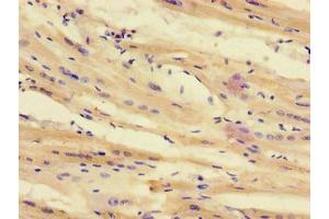 Immunohistochemistry of paraffin-embedded human heart tissue using ABIN7171701 at dilution of 1:100 (TTI1 antibody  (AA 692-858))