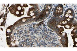 ABIN6269326 at 1/100 staining Mouse intestine tissue by IHC-P.