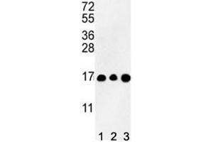 Western blot analysis of HIST3H3 antibody and (1) CEM, (2) K562, and (3) HL-60 lysate (Histone Cluster 3, H3 (HIST3H3) (AA 1-30) antibody)