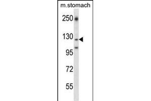 LC2 Antibody (Center) (ABIN657905 and ABIN2846856) western blot analysis in mouse stomach tissue lysates (35 μg/lane). (LAMC2 antibody  (AA 941-970))