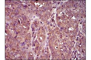 Immunohistochemistry (IHC) image for anti-Interleukin 3 Receptor, alpha (IL3RA) (AA 200-305) antibody (ABIN1845738) (IL3RA antibody  (AA 200-305))