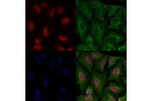 ABIN7093646 and ABIN7097672 staining  cells by IF/ICC. (HBP1 antibody)