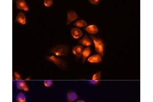 Immunofluorescence analysis of Hela cells using TIM-3/HAVCR2 Polyclonal Antibody at dilution of 1:100 (40x lens). (TIM3 antibody)