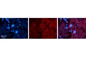 Rabbit Anti-SF1 Antibody   Formalin Fixed Paraffin Embedded Tissue: Human heart Tissue Observed Staining: Nucleus Primary Antibody Concentration: 1:100 Other Working Concentrations: N/A Secondary Antibody: Donkey anti-Rabbit-Cy3 Secondary Antibody Concentration: 1:200 Magnification: 20X Exposure Time: 0. (Splicing Factor 1 antibody  (Middle Region))