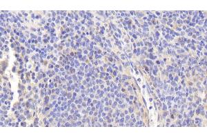 Detection of eNOS in Human Spleen Tissue using Polyclonal Antibody to Endothelial NOS (eNOS) (ENOS antibody  (AA 756-888))
