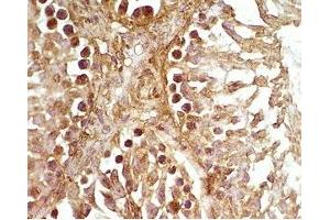 Rat testis tissue was stained by Rabbit Anti-Desnutrin (465-486) (Mouse) Serum (PNPLA2 antibody  (AA 465-486))