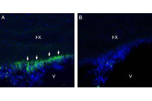 Immunohistochemistry (IHC) image for anti-Interleukin 6 Signal Transducer (Gp130, Oncostatin M Receptor) (IL6ST) (AA 584-598), (Extracellular) antibody (ABIN7043291)