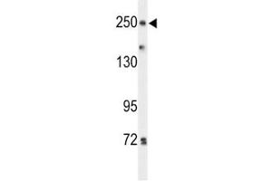 Western blot analysis of PTPRD antibody and HeLa lysate. (PTPRD antibody  (AA 343-371))