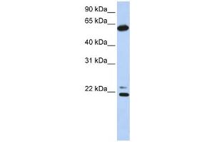 Western Blotting (WB) image for anti-Chaperonin Containing TCP1, Subunit 5 (Epsilon) (CCT5) antibody (ABIN2459816) (CCT5 antibody)