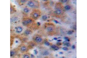 Used in DAB staining on fromalin fixed paraffin-embedded Liver tissue (GSTA1 antibody  (AA 2-222))