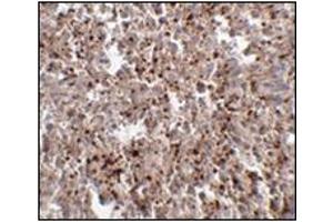 Immunohistochemistry of Mett7LB in human spleen tissue with this product at 2.