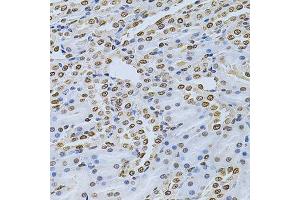 Immunohistochemistry of paraffin-embedded rat kidney using ILK Antibody. (ILK antibody  (AA 1-260))