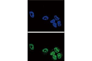 Confocal immunofluorescent analysis of PLA2G4A Antibody with NCI-H460 cell followed by Alexa Fluor488-conjugated goat anti-rabbit lgG (green). (PLA2G4A antibody  (AA 513-541))