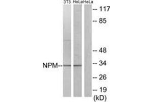 Western blot analysis of extracts from HeLa/NIH-3T3 cells, using NPM (Ab-234) Antibody. (NPM1 antibody  (AA 201-250))