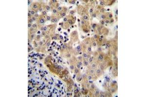 Immunohistochemistry analysis in formalin fixed and paraffin embedded human liver tissue reacted with LIN7C Antibdy (C-term) followed by peroxidase conjugation of the secondary antibody and DAB staining.