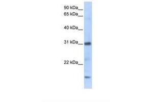 Image no. 1 for anti-Chemokine (C-X-C Motif) Ligand 16 (CXCL16) (C-Term) antibody (ABIN6737989)