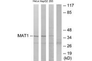 Western blot analysis of extracts from HeLa/HepG2/293 cells, using MAT1 Antibody. (MAT1A antibody  (AA 91-140))