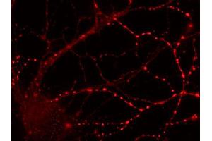 Immunocytochemistry on cultured hippocampus neurons (dilution 1 : 500). (Rab3c antibody  (AA 154-227))