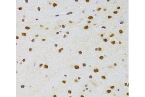 Immunohistochemistry of paraffin-embedded Rat brain using CSRP3 Polyclonal Antibody at dilution of 1:100 (40x lens).