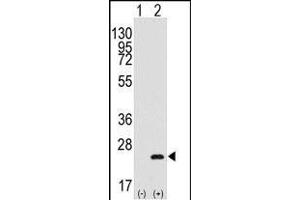 Western blot analysis of BarX1(arrow) using rabbit polyclonal BarX1 Antibody (C-term) (R). (BARX1 antibody  (AA 119-148))